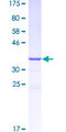BOB / GPR15 Protein - 12.5% SDS-PAGE Stained with Coomassie Blue.