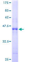 BOC Protein - 12.5% SDS-PAGE of human BOC stained with Coomassie Blue