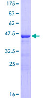 BOD1 Protein - 12.5% SDS-PAGE of human FAM44B stained with Coomassie Blue