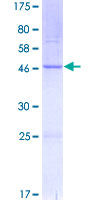 BOK Protein - 12.5% SDS-PAGE of human BOK stained with Coomassie Blue