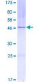 BOK Protein - 12.5% SDS-PAGE of human BOK stained with Coomassie Blue