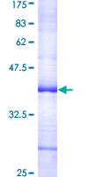 BOK Protein - 12.5% SDS-PAGE Stained with Coomassie Blue.