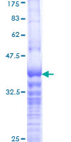 BOLA1 Protein - 12.5% SDS-PAGE Stained with Coomassie Blue.
