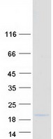 BOLA1 Protein - Purified recombinant protein BOLA1 was analyzed by SDS-PAGE gel and Coomassie Blue Staining
