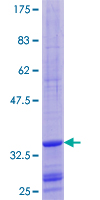 BOLA3 Protein - 12.5% SDS-PAGE of human BOLA3 stained with Coomassie Blue