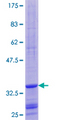 BOLA3 Protein - 12.5% SDS-PAGE of human BOLA3 stained with Coomassie Blue