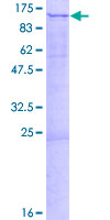 BOP1 Protein - 12.5% SDS-PAGE of human BOP1 stained with Coomassie Blue