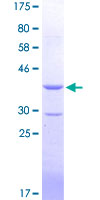 BOULE / BOLL Protein - 12.5% SDS-PAGE Stained with Coomassie Blue.