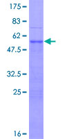 BP1 / DLX4 Protein - 12.5% SDS-PAGE of human DLX4 stained with Coomassie Blue