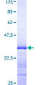 BP1 / DLX4 Protein - 12.5% SDS-PAGE Stained with Coomassie Blue.