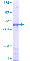 BPGM Protein - 12.5% SDS-PAGE of human BPGM stained with Coomassie Blue