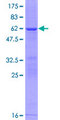 BPGM Protein - 12.5% SDS-PAGE of human BPGM stained with Coomassie Blue