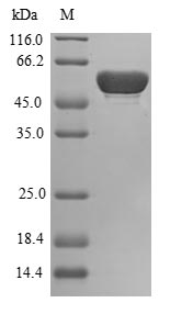 BPGM Protein - (Tris-Glycine gel) Discontinuous SDS-PAGE (reduced) with 5% enrichment gel and 15% separation gel.