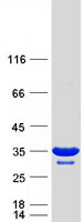 BPGM Protein - Purified recombinant protein BPGM was analyzed by SDS-PAGE gel and Coomassie Blue Staining