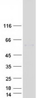 BPI Protein - Purified recombinant protein BPI was analyzed by SDS-PAGE gel and Coomassie Blue Staining