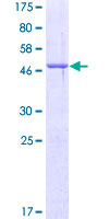 BPIFA1 / SPLUNC1 Protein - 12.5% SDS-PAGE of human PLUNC stained with Coomassie Blue