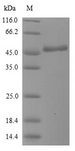 BPIFA2 / SPLUNC2 Protein - (Tris-Glycine gel) Discontinuous SDS-PAGE (reduced) with 5% enrichment gel and 15% separation gel.