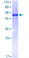 BPIFA2 / SPLUNC2 Protein - 12.5% SDS-PAGE of human C20orf70 stained with Coomassie Blue