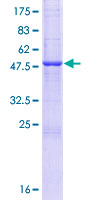 BPIFA3 / SPLUNC3 Protein - 12.5% SDS-PAGE of human C20orf71 stained with Coomassie Blue