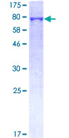 BPIFB1 Protein - 12.5% SDS-PAGE of human C20orf114 stained with Coomassie Blue