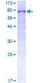 BPIFB1 Protein - 12.5% SDS-PAGE of human C20orf114 stained with Coomassie Blue