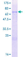 BPIFB2 Protein - 12.5% SDS-PAGE of human BPIL1 stained with Coomassie Blue