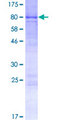 BPIFB4 / LPLUNC4 Protein - 12.5% SDS-PAGE of human C20orf186 stained with Coomassie Blue