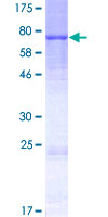BPIFB6 / BPIL3 Protein - 12.5% SDS-PAGE of human BPIL3 stained with Coomassie Blue