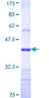 BPOZ / ABTB1 Protein - 12.5% SDS-PAGE Stained with Coomassie Blue.