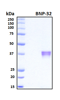 Brain Natriuretic Peptide 32 Protein - SDS-PAGE under reducing conditions and visualized by Coomassie blue staining