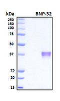 Brain Natriuretic Peptide 32 Protein - SDS-PAGE under reducing conditions and visualized by Coomassie blue staining