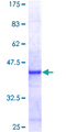 Brain Protein 44 / BRP44 Protein - 12.5% SDS-PAGE of human BRP44 stained with Coomassie Blue