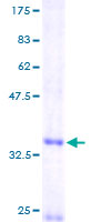 BRAK / CXCL14 Protein - 12.5% SDS-PAGE of human CXCL14 stained with Coomassie Blue