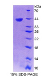 BRAK / CXCL14 Protein - Recombinant Breast And Kidney Expressed Chemokine By SDS-PAGE