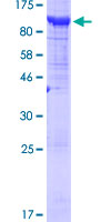 BRAT1 / BAAT1 Protein - 12.5% SDS-PAGE of human C7orf27 stained with Coomassie Blue