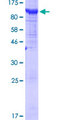 BRAT1 / BAAT1 Protein - 12.5% SDS-PAGE of human C7orf27 stained with Coomassie Blue