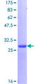 BRCA1 Protein - 12.5% SDS-PAGE of human BRCA1 stained with Coomassie Blue