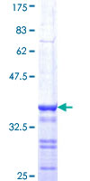 BRCA1 Protein - 12.5% SDS-PAGE Stained with Coomassie Blue.