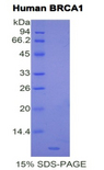 BRCA1 Protein - Recombinant Breast Cancer Susceptibility Protein 1 By SDS-PAGE