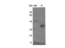 BRCA1 Protein - Recombinant Human BRCA1 Protein (His Tag)-Elabscience