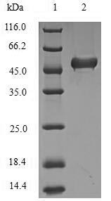 BRCC3 / BRCC36 Protein - (Tris-Glycine gel) Discontinuous SDS-PAGE (reduced) with 5% enrichment gel and 15% separation gel.