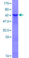 BRCC3 / BRCC36 Protein - 12.5% SDS-PAGE of human BRCC3 stained with Coomassie Blue