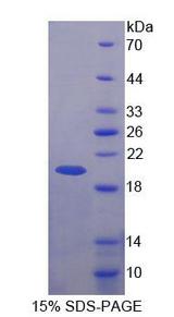 BRCC3 / BRCC36 Protein - Recombinant BRCA1/BRCA2 Containing Complex Subunit 3 By SDS-PAGE