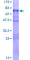 BRCC45 / BRE Protein - 12.5% SDS-PAGE of human BRE stained with Coomassie Blue