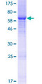BRCTD1 / ANKRD32 Protein - 12.5% SDS-PAGE of human ANKRD32 stained with Coomassie Blue