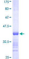BRD2 / RING3 Protein - 12.5% SDS-PAGE Stained with Coomassie Blue.