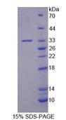 BRD2 / RING3 Protein - Recombinant Bromodomain Containing Protein 2 (BRD2) by SDS-PAGE