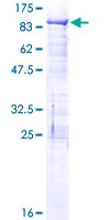 BRD3 Protein - 12.5% SDS-PAGE of human BRD3 stained with Coomassie Blue