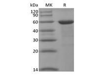 BRD4 Protein - Recombinant Human BRD4 (N-10His-Flag)