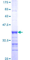 BRD8 Protein - 12.5% SDS-PAGE Stained with Coomassie Blue.